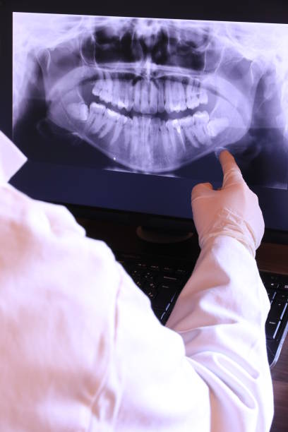 Best Emergency Root Canal Treatment in Edgerton, MN